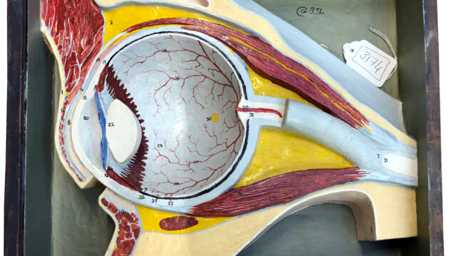 Plaster model of eye