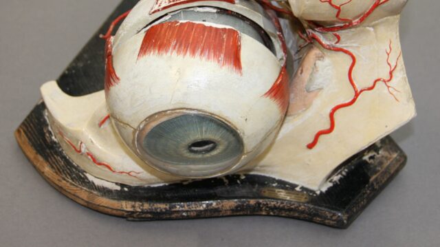 Plaster model of human eye