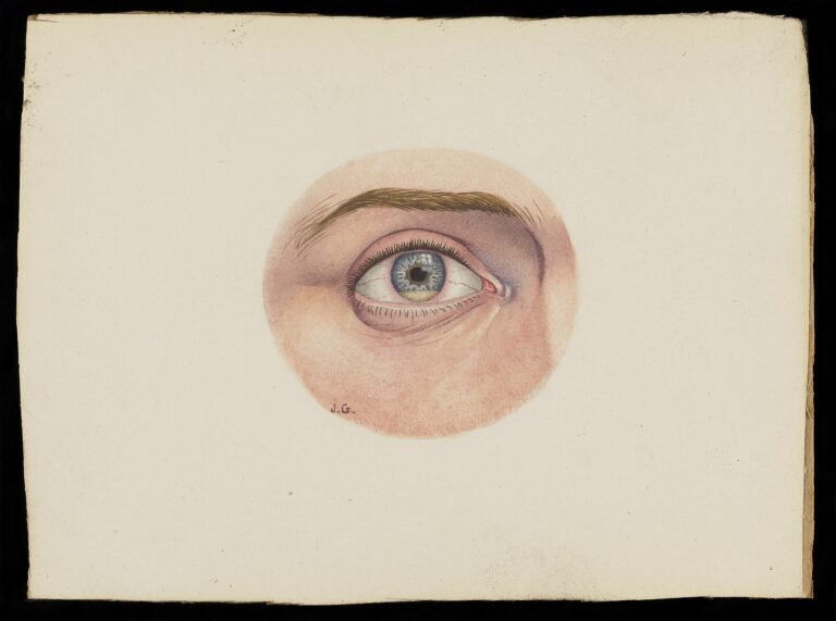 Landscape piece of paper with a watercolour medical illustration of a single left eye.